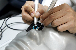 A simple surgical procedure can restore vision lost to cataracts.